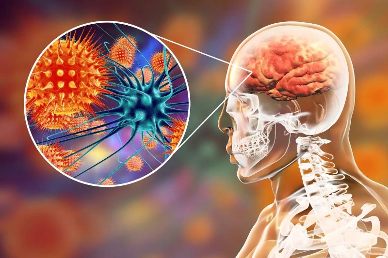 432736-common-virus-could-causing-alzheimer | ویروسی شایع می‌تواند عامل نوعی آلزایمر باشد