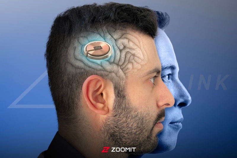 432892-musk-says-neuralink-implanted-third-patient-with-brain-device | ایلان ماسک از کاشت سومین تراشه نورالینک در مغز یک بیمار خبر داد