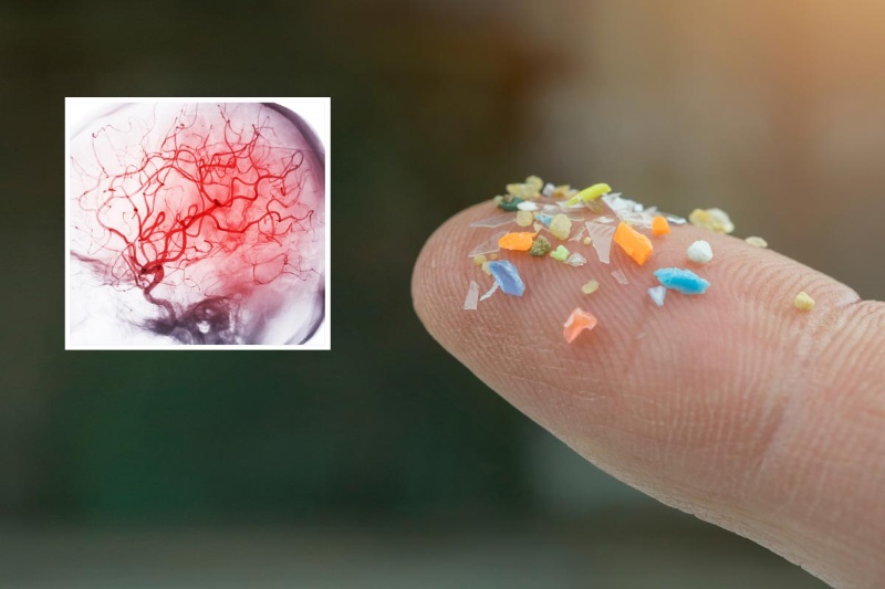 434148-microplastics-block-blood-flow-brain-mice | میکروپلاستیک‌ها می‌توانند جریان خون در مغز را مسدود کنند